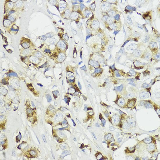 Polyclonal Rabbit anti-Human CFB / Complement Factor B Antibody (IHC, IF, WB)
