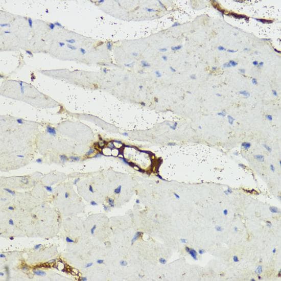 Polyclonal Rabbit anti-Human CFB / Complement Factor B Antibody (IHC, IF, WB)