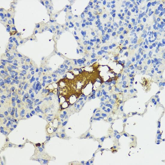Polyclonal Rabbit anti-Human CFB / Complement Factor B Antibody (IHC, IF, WB)