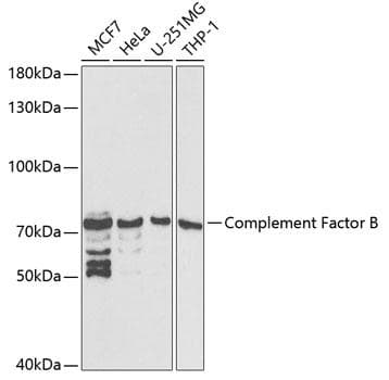 Polyclonal Rabbit anti-Human CFB / Complement Factor B Antibody (IHC, IF, WB)