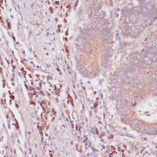 IFNAR2 Antibody