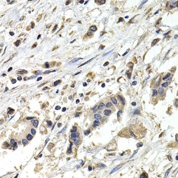 Polyclonal Rabbit anti-Human BUB1B / BubR1 Antibody (IHC, IF)
