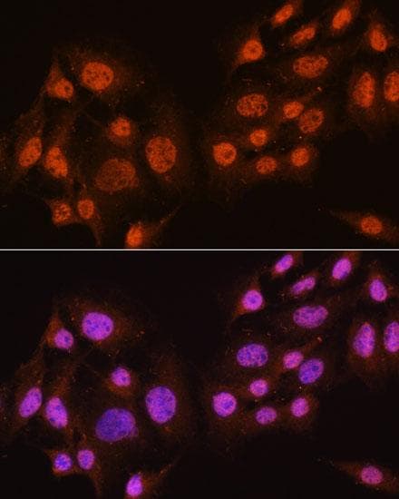 Polyclonal Rabbit anti-Human AKT1 Antibody (IF)