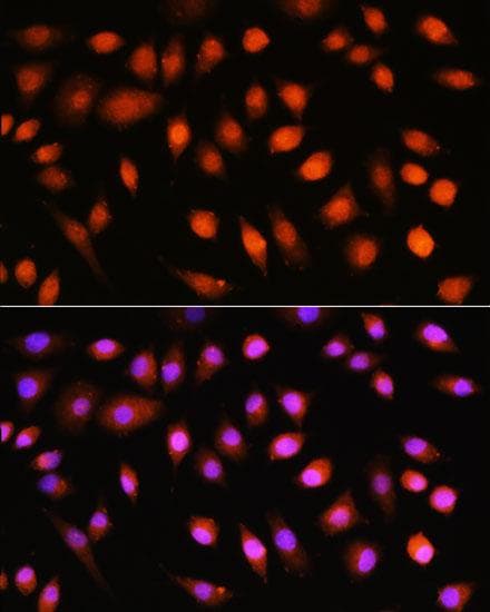 Polyclonal Rabbit anti-Human AKT1 Antibody (IF)