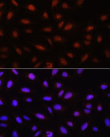 Polyclonal Rabbit anti-Human AKT1 Antibody (IF)