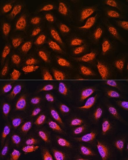 PNPO Antibody