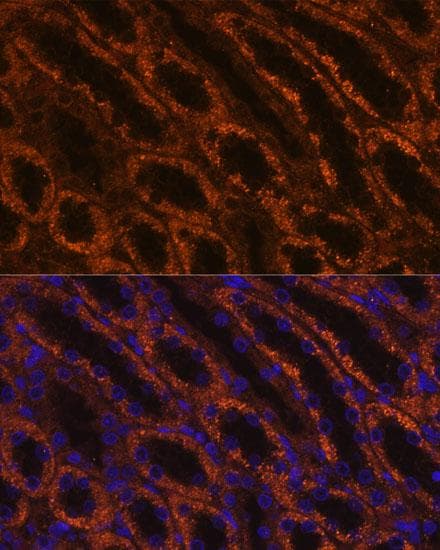 Polyclonal Rabbit anti-Human LAMC2 / Laminin Gamma 2 Antibody (IF)