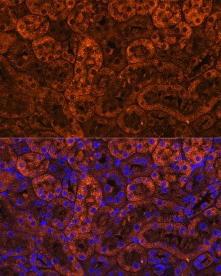 Polyclonal Rabbit anti-Human LAMC2 / Laminin Gamma 2 Antibody (IF)