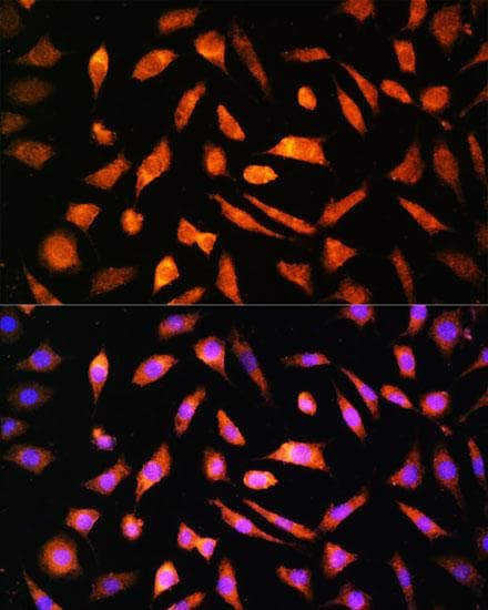 Polyclonal Rabbit anti-Human NPPB / BNP Antibody (IF, WB)