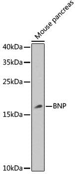 Polyclonal Rabbit anti-Human NPPB / BNP Antibody (IF, WB)