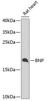 Polyclonal Rabbit anti-Human NPPB / BNP Antibody (IF, WB)