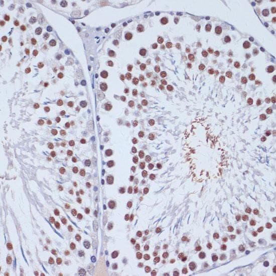 Polyclonal Rabbit anti-Human DNMT3L Antibody (IHC, IF)