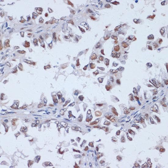 Polyclonal Rabbit anti-Human DNMT3L Antibody (IHC, IF)