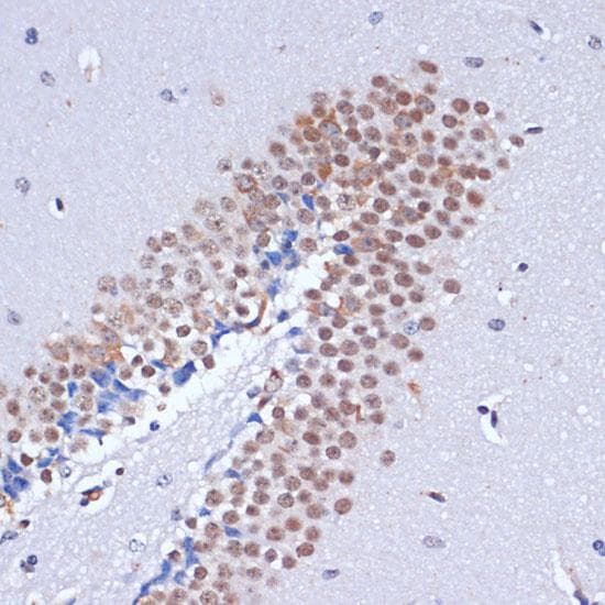 Polyclonal Rabbit anti-Human DNMT3L Antibody (IHC, IF)