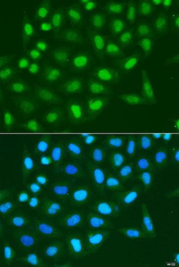 Histone H3 Antibody