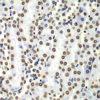 Polyclonal Rabbit anti-Human Histone H3 Antibody (IHC, WB)