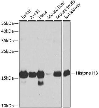 Polyclonal Rabbit anti-Human Histone H3 Antibody (IHC, WB)
