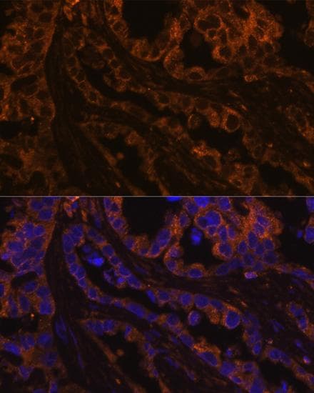 KRT7 / CK7 / Cytokeratin 7 Antibody