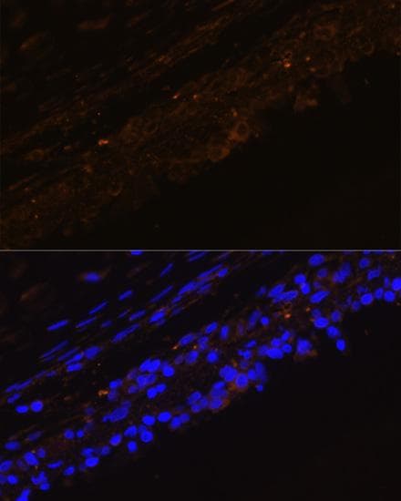 KRT7 / CK7 / Cytokeratin 7 Antibody