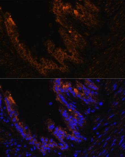 KRT7 / CK7 / Cytokeratin 7 Antibody