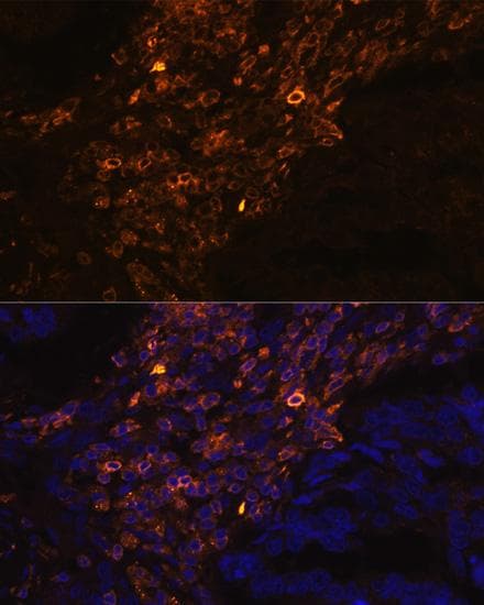 KRT7 / CK7 / Cytokeratin 7 Antibody
