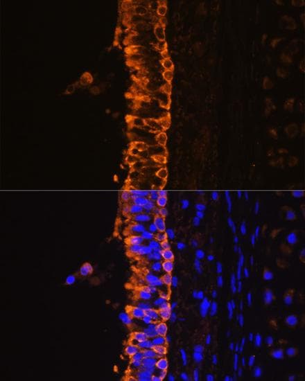 KRT7 / CK7 / Cytokeratin 7 Antibody