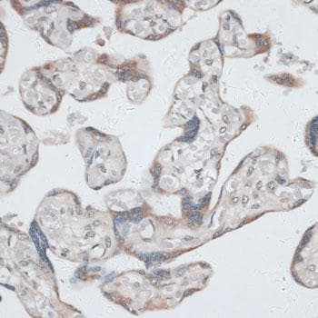 KRT7 / CK7 / Cytokeratin 7 Antibody