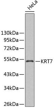 KRT7 / CK7 / Cytokeratin 7 Antibody