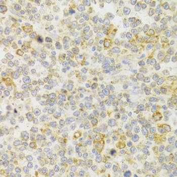 Polyclonal Rabbit anti-Human KISS1R / GPR54 Antibody (IHC, WB)