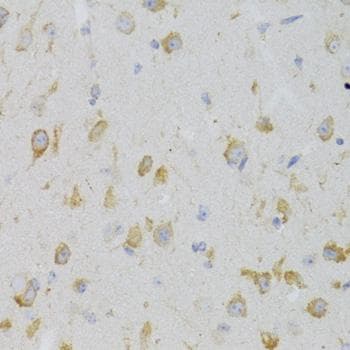 Polyclonal Rabbit anti-Human KISS1R / GPR54 Antibody (IHC, WB)