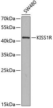 Polyclonal Rabbit anti-Human KISS1R / GPR54 Antibody (IHC, WB)