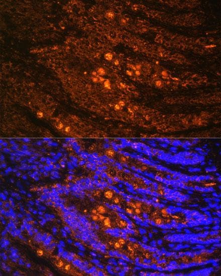 Polyclonal Rabbit anti-Human TLN1 / Talin 1 Antibody (IF)