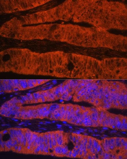 Polyclonal Rabbit anti-Human TLN1 / Talin 1 Antibody (IF)