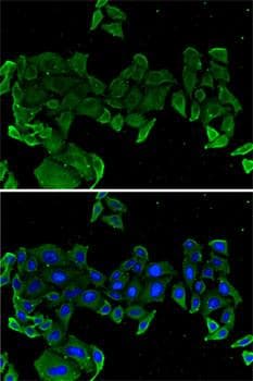 Polyclonal Rabbit anti-Human COMP / THBS5 Antibody (IF, WB)
