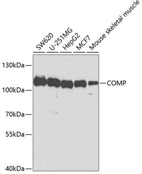 Polyclonal Rabbit anti-Human COMP / THBS5 Antibody (IF, WB)
