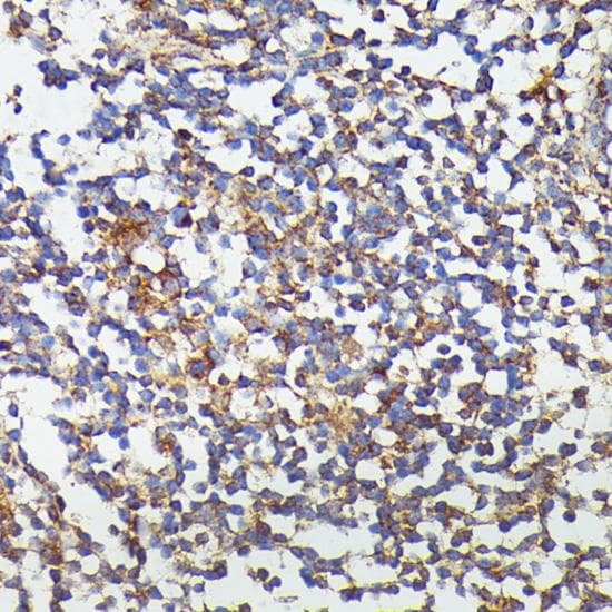 Polyclonal Rabbit anti-Human CSF3 / G-CSF Antibody (IHC)