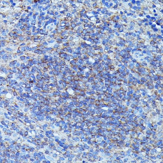 Polyclonal Rabbit anti-Human CSF3 / G-CSF Antibody (IHC)