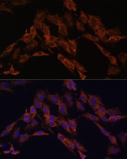 Polyclonal Rabbit anti-Human ENOX2 Antibody (IF, WB)