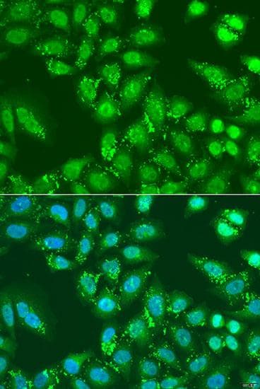 Polyclonal Rabbit anti-Human HDAC4 Antibody (IHC, IF)