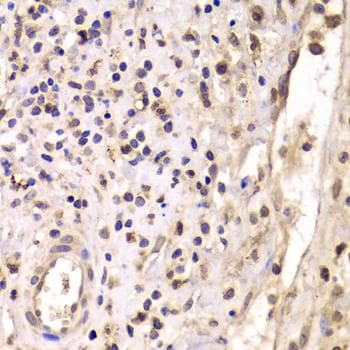 Polyclonal Rabbit anti-Human HDAC4 Antibody (IHC, IF)