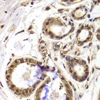 Polyclonal Rabbit anti-Human HDAC4 Antibody (IHC, IF)