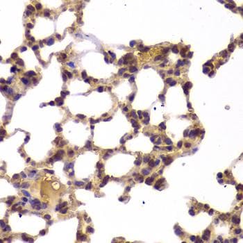 Polyclonal Rabbit anti-Human HDAC4 Antibody (IHC, IF)