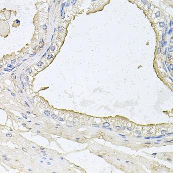 Polyclonal Rabbit anti-Human HPR Antibody (IHC)