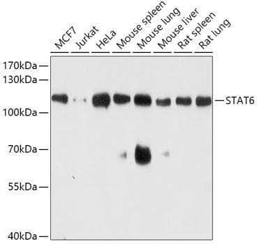 Polyclonal Rabbit anti-Human STAT6 Antibody (WB)