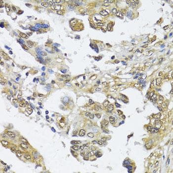 Polyclonal Rabbit anti-Human HDAC2 Antibody (IHC)
