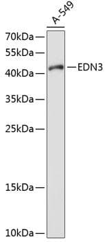Polyclonal Rabbit anti-Human Endothelin 3 / EDN3 Antibody (WB)