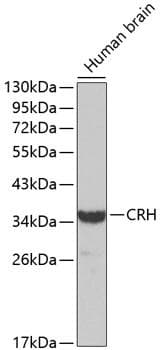 Polyclonal Rabbit anti-Human CRH / CRF Antibody (WB)