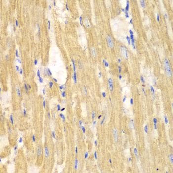 Polyclonal Rabbit anti-Human CAPN1 / Calpain 1 Antibody (IHC)