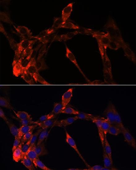 Polyclonal Rabbit anti-Human JAG1 / Jagged 1 Antibody (IF)