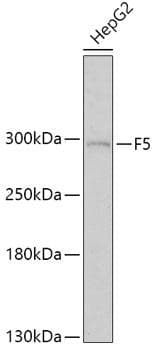 Polyclonal Rabbit anti-Human F5 / Factor Va Antibody (WB)